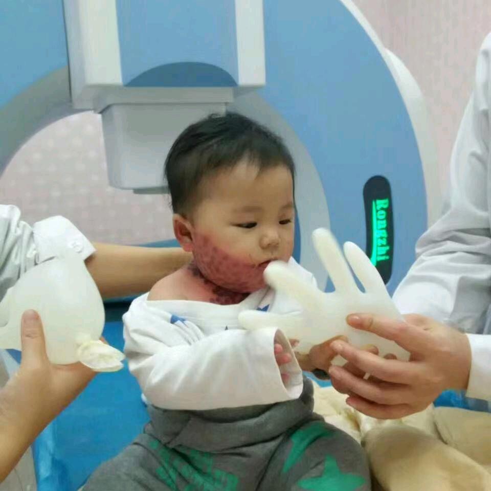 胎记之旅