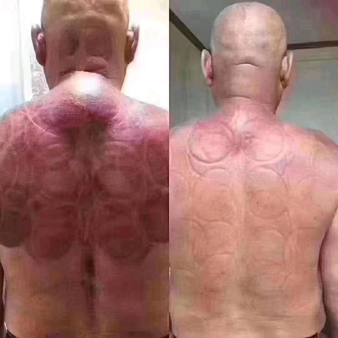 中医技术调理，免费体验，一次见效