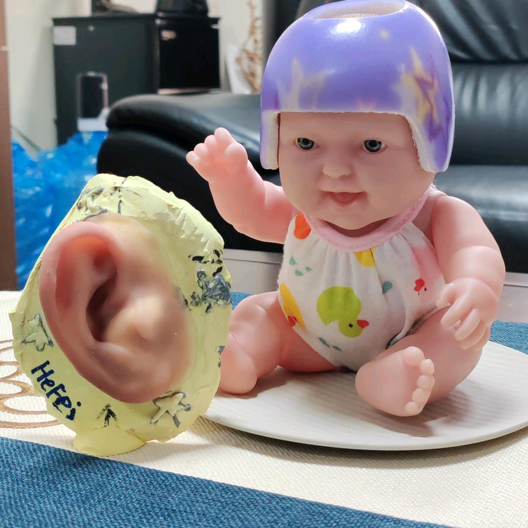 无创矫形—安徽爱耳