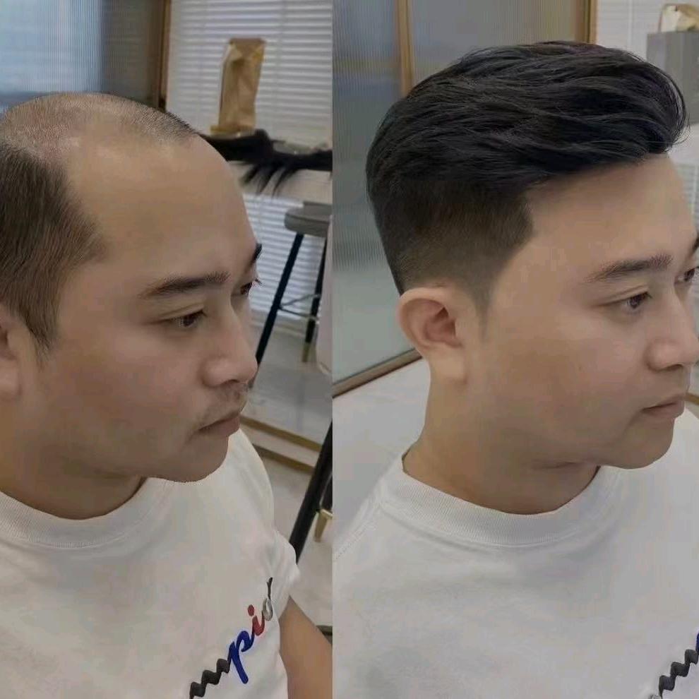 阿甘男士假发补发