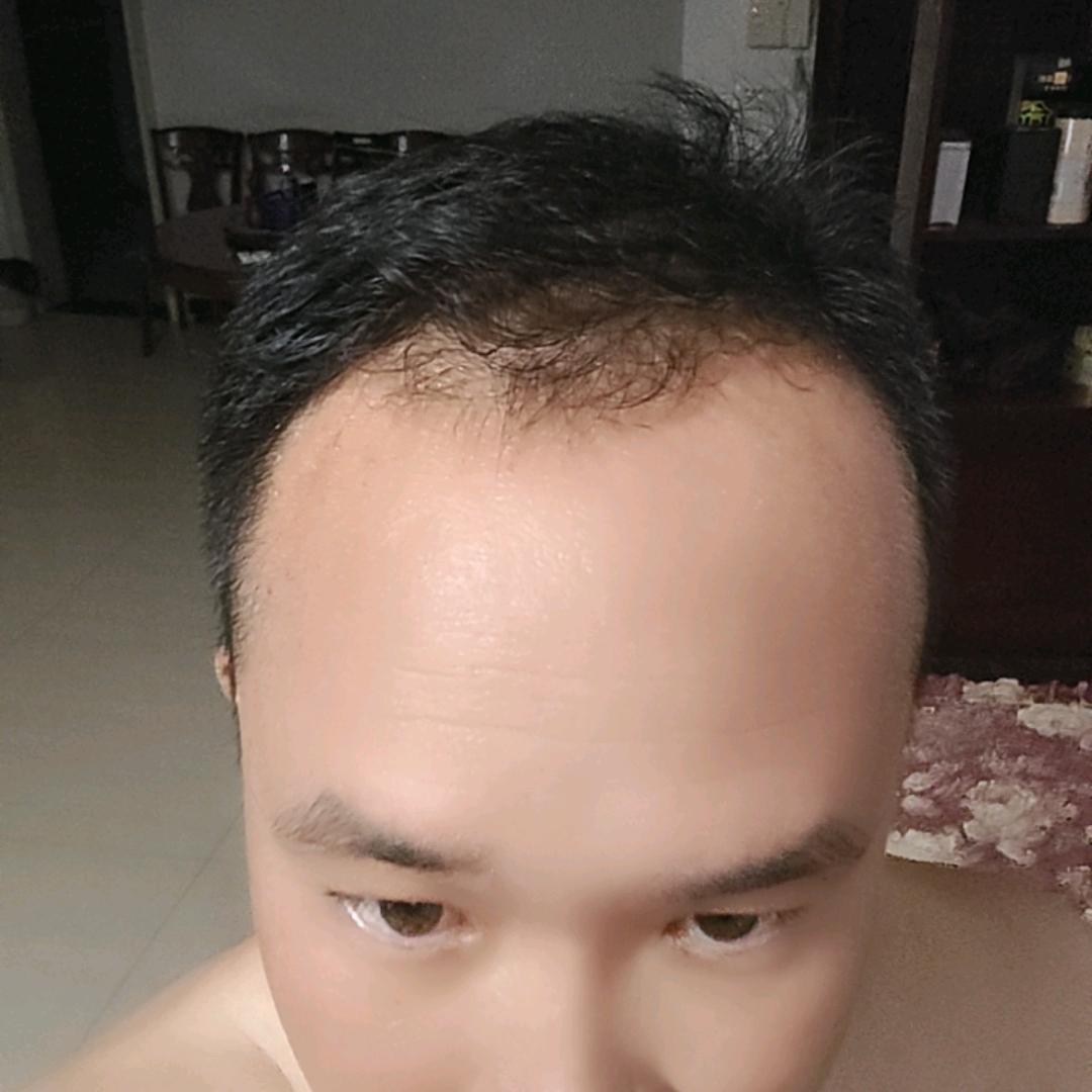 大兵兵记录养发