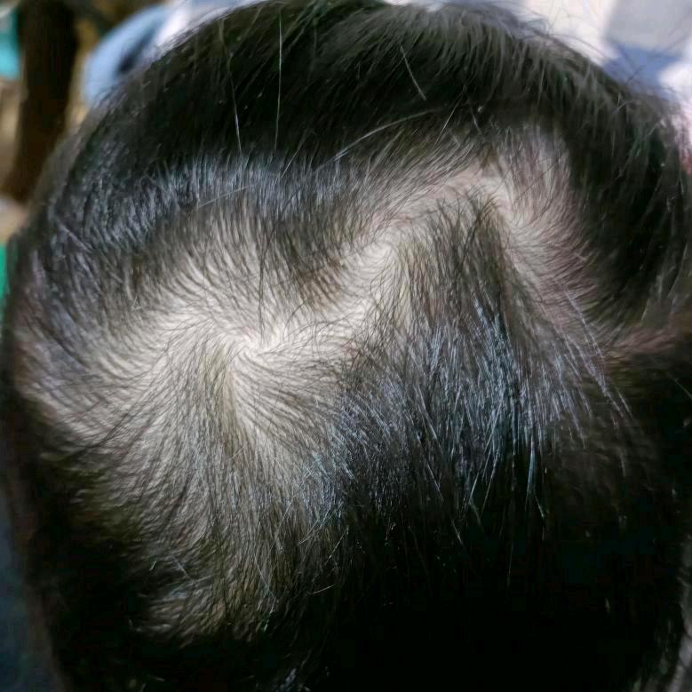 壬（ren）森选泽