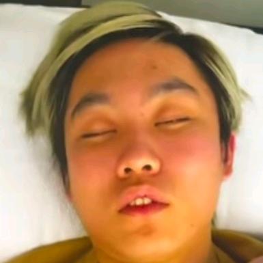 小弹