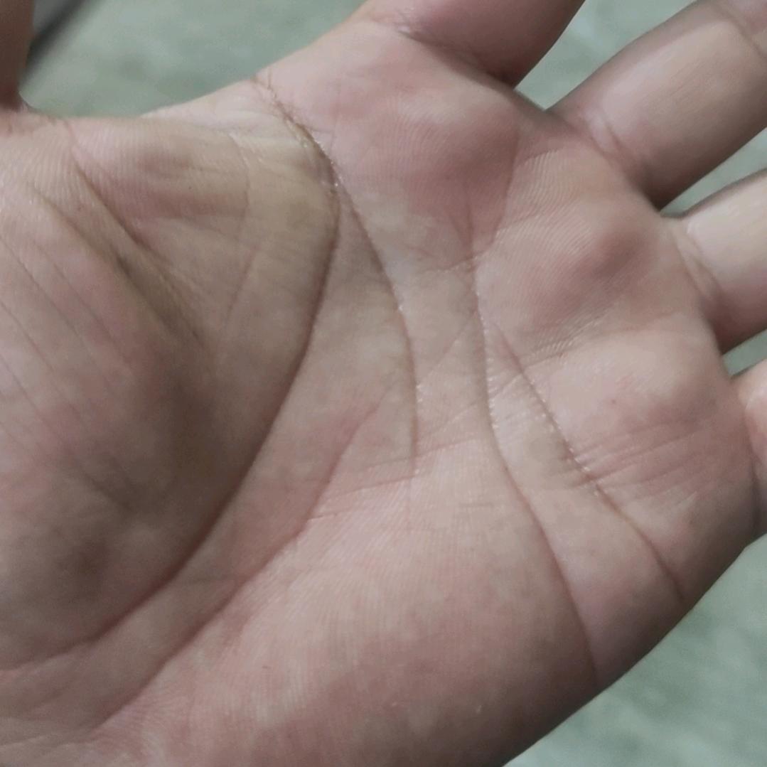 ✋🏻分析(回关解析)