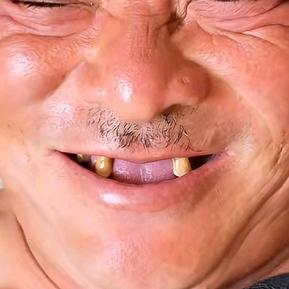 老豆芽