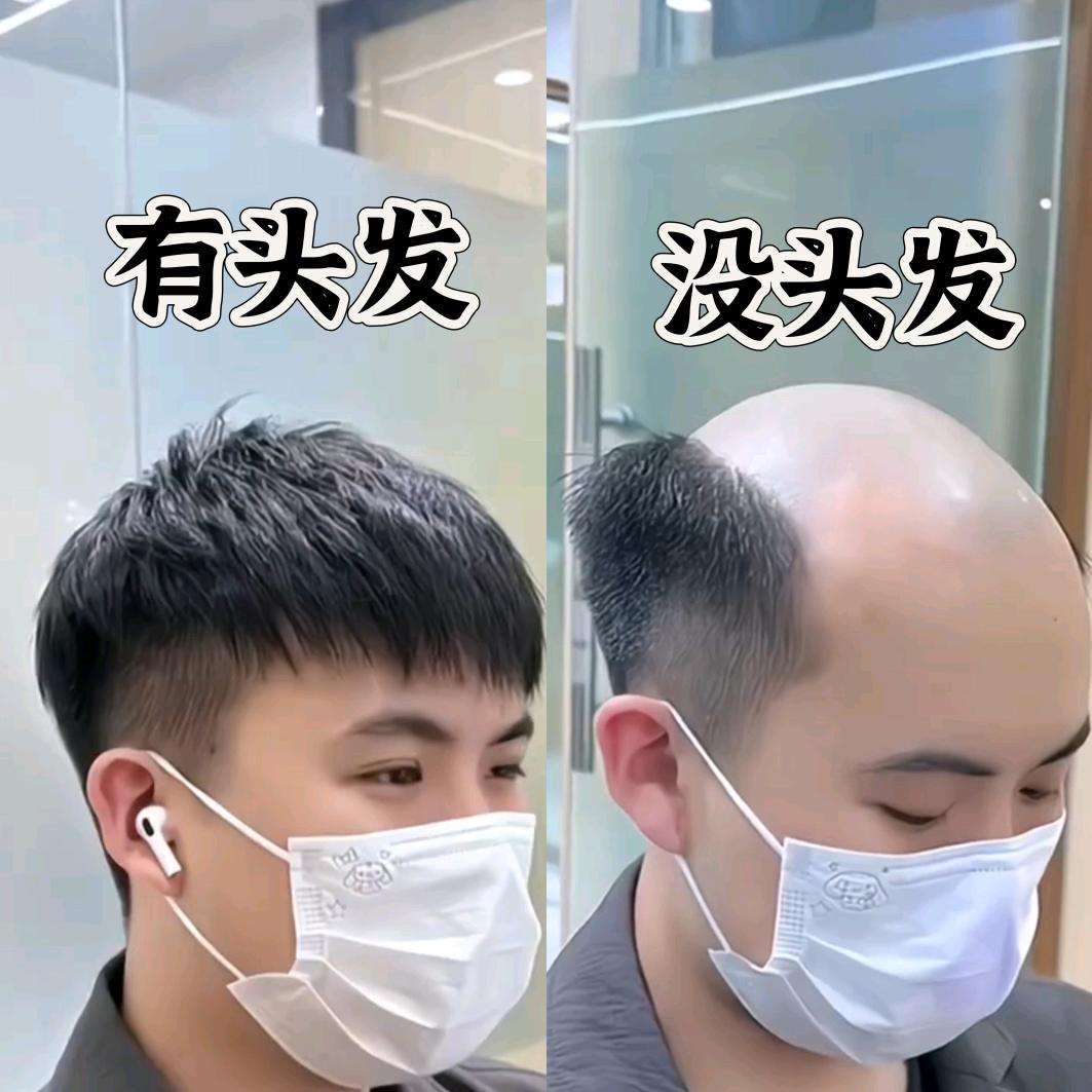 优美滋男士假发信息咨询工作室_可上门