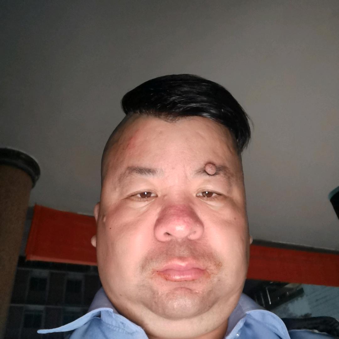 辉少