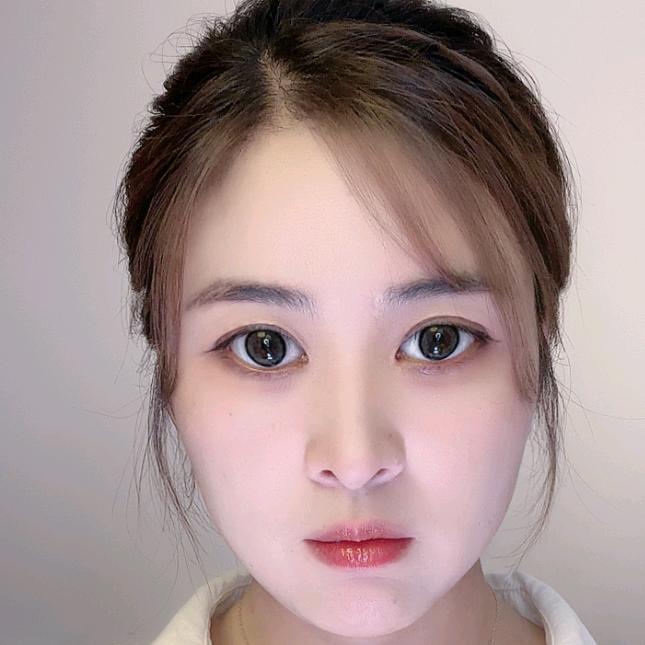 小叶