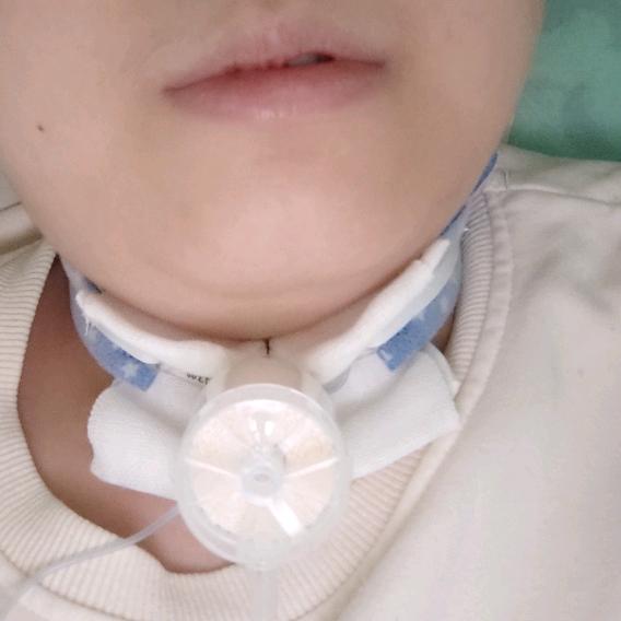 努力打怪兽的乐宝