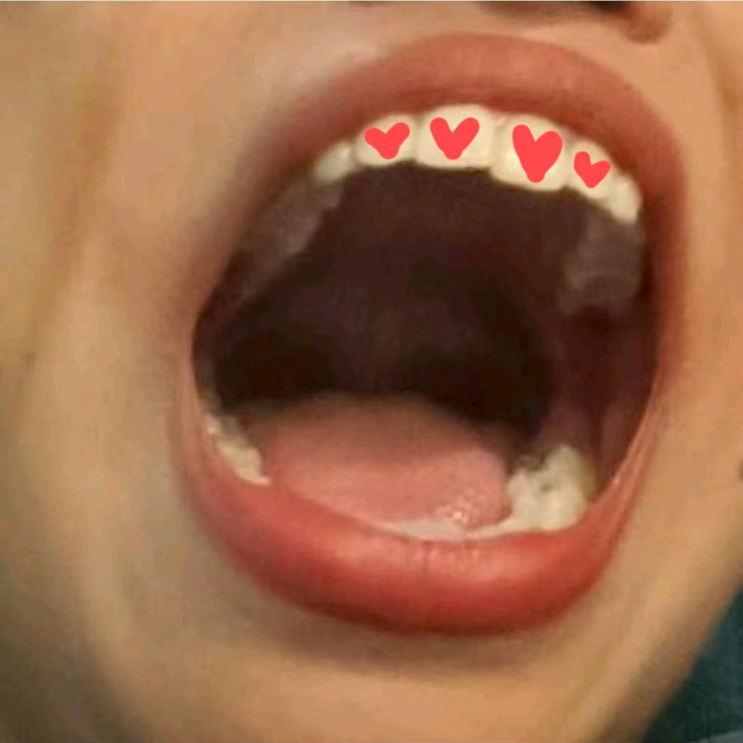 不说话的大嘴