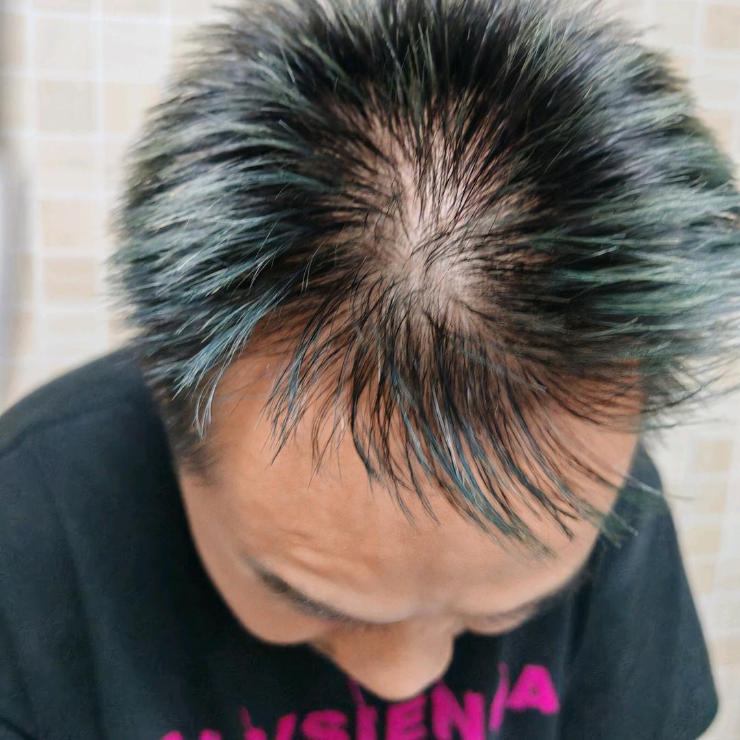 养头发的托尼2号