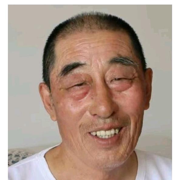 张戈