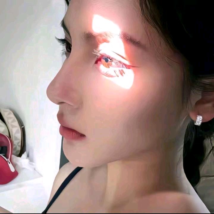 余