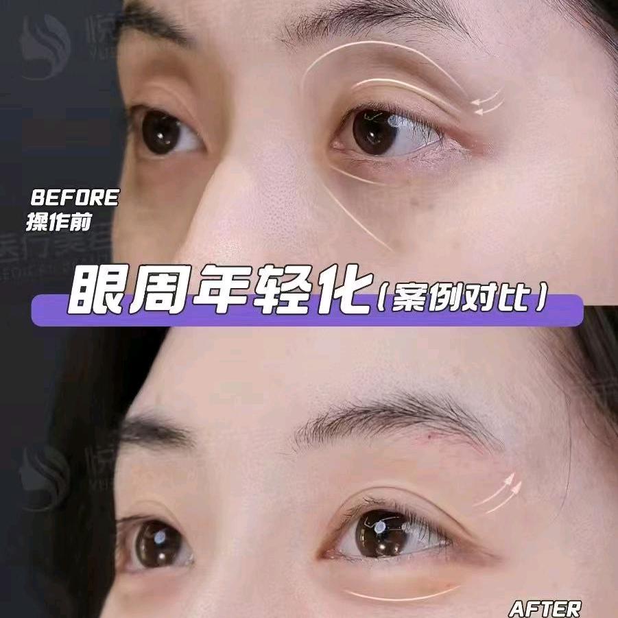 哟哟哟