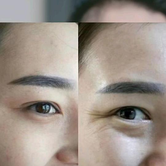 刘姐皱纹皱纹操