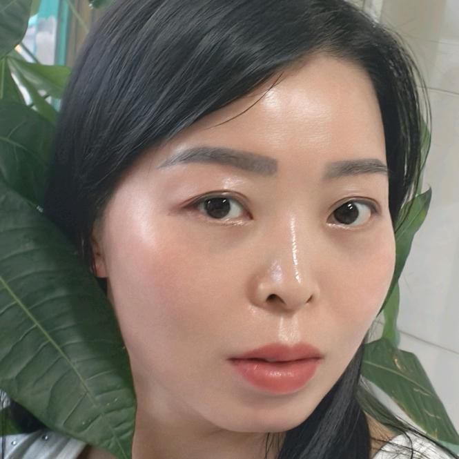 常州免费祛斑一次掉（小河店）