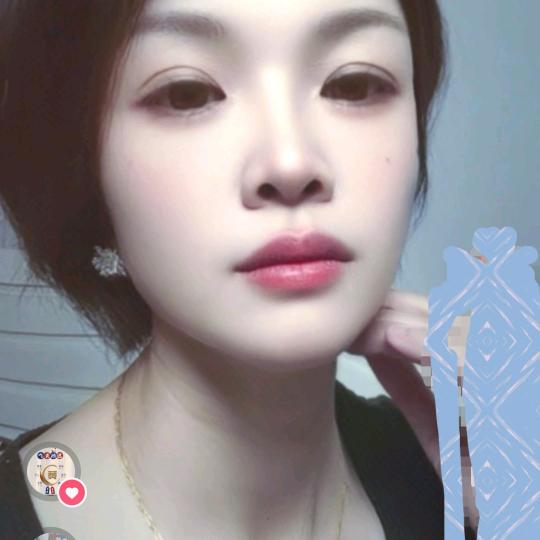 芳