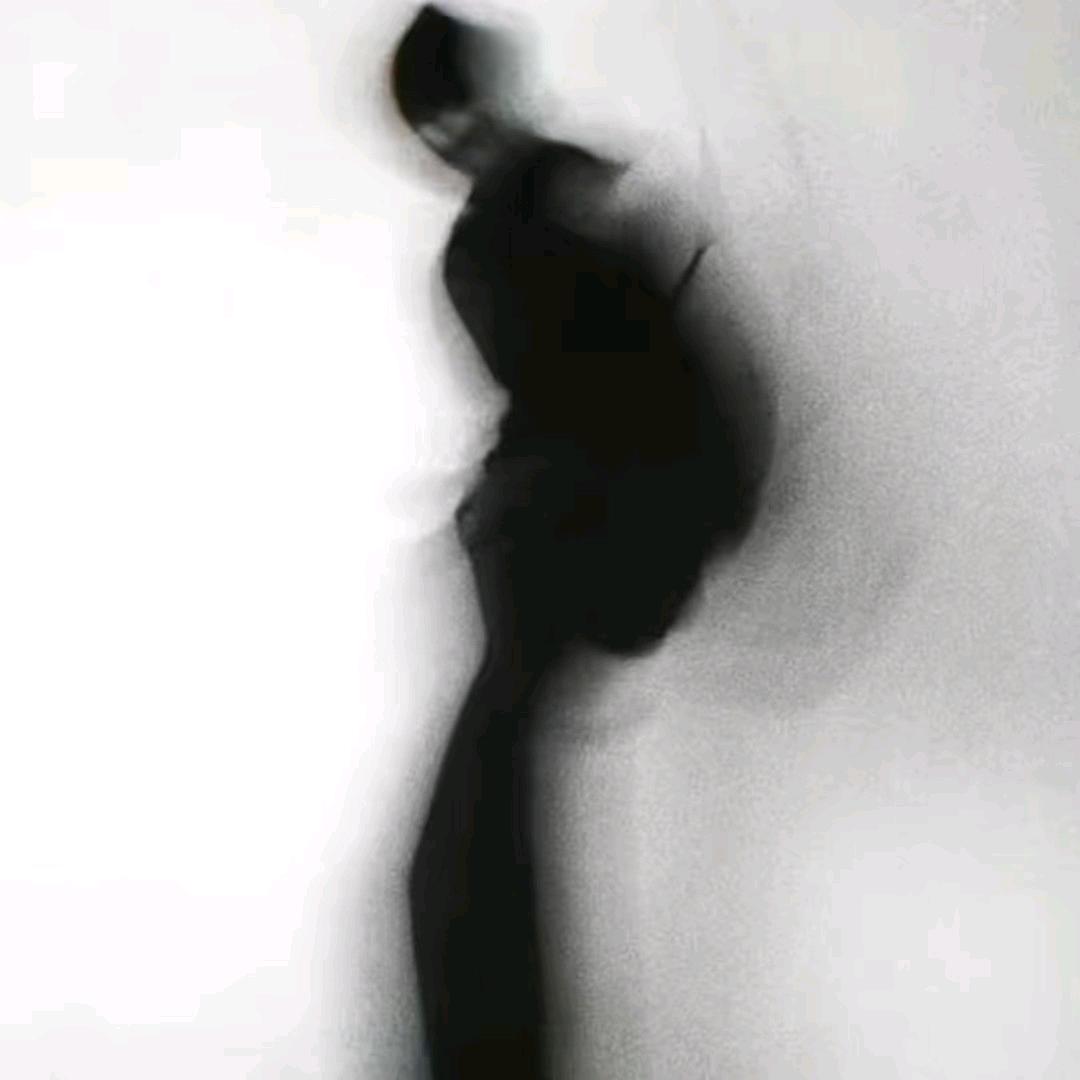 左心房