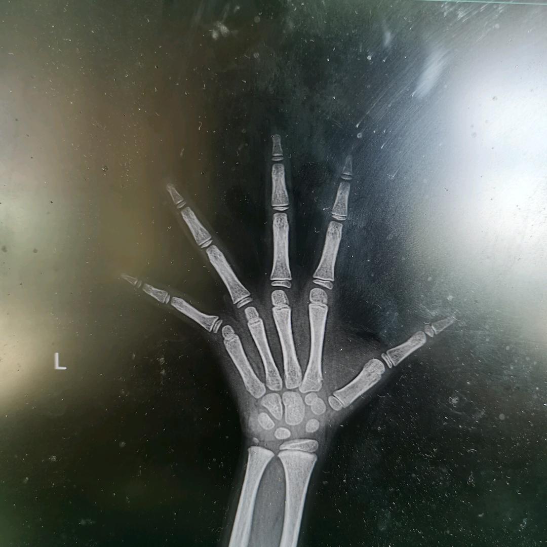 娜拉