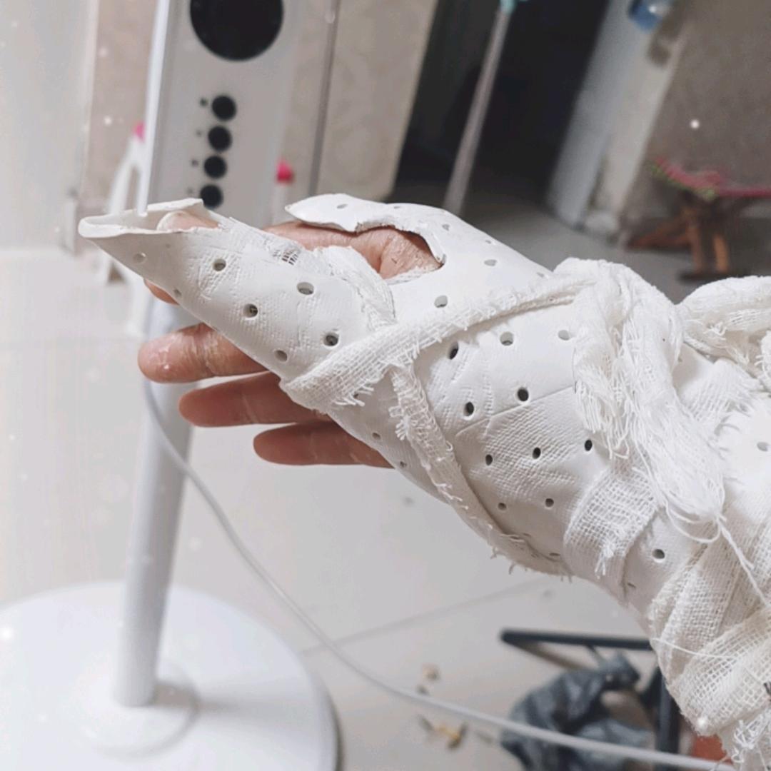 腕舟骨骨折有和我一样的吗