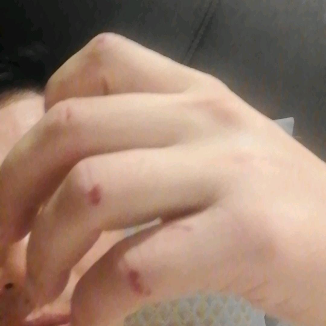 刺猬