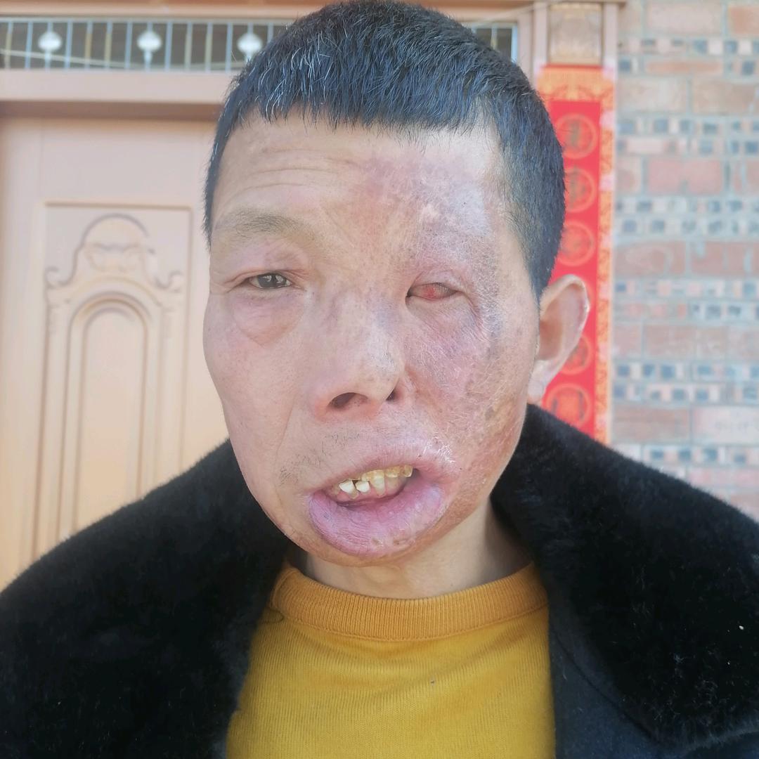 刘先保