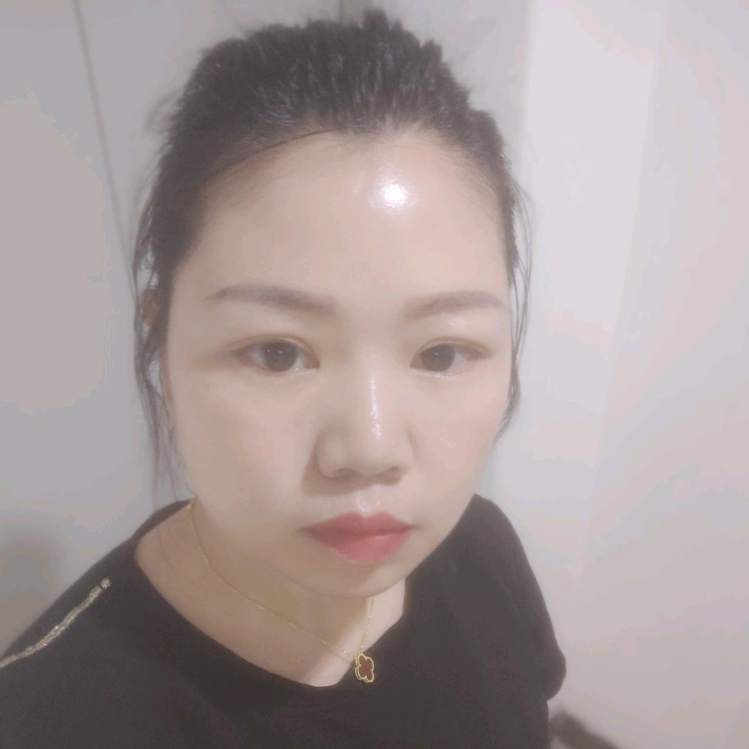 小琳