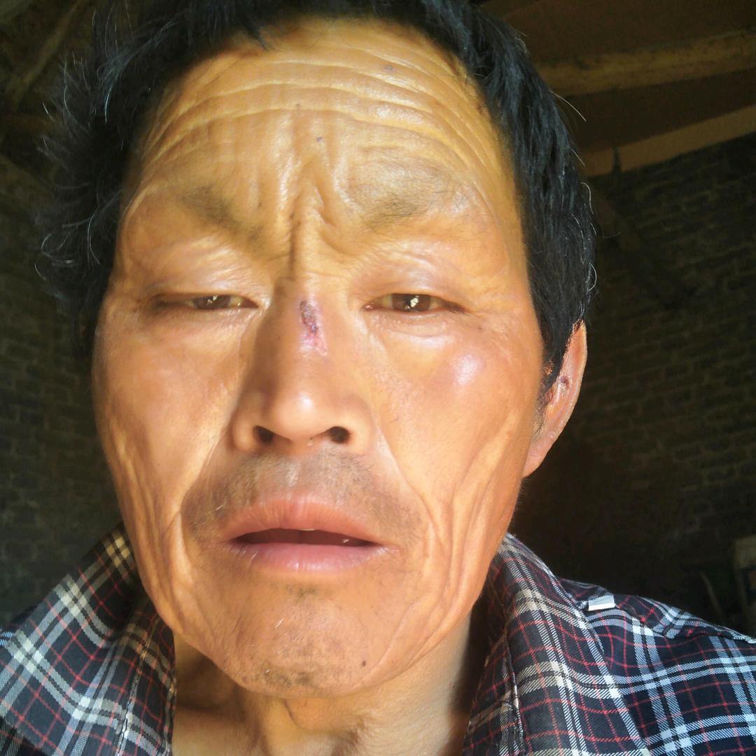 李
