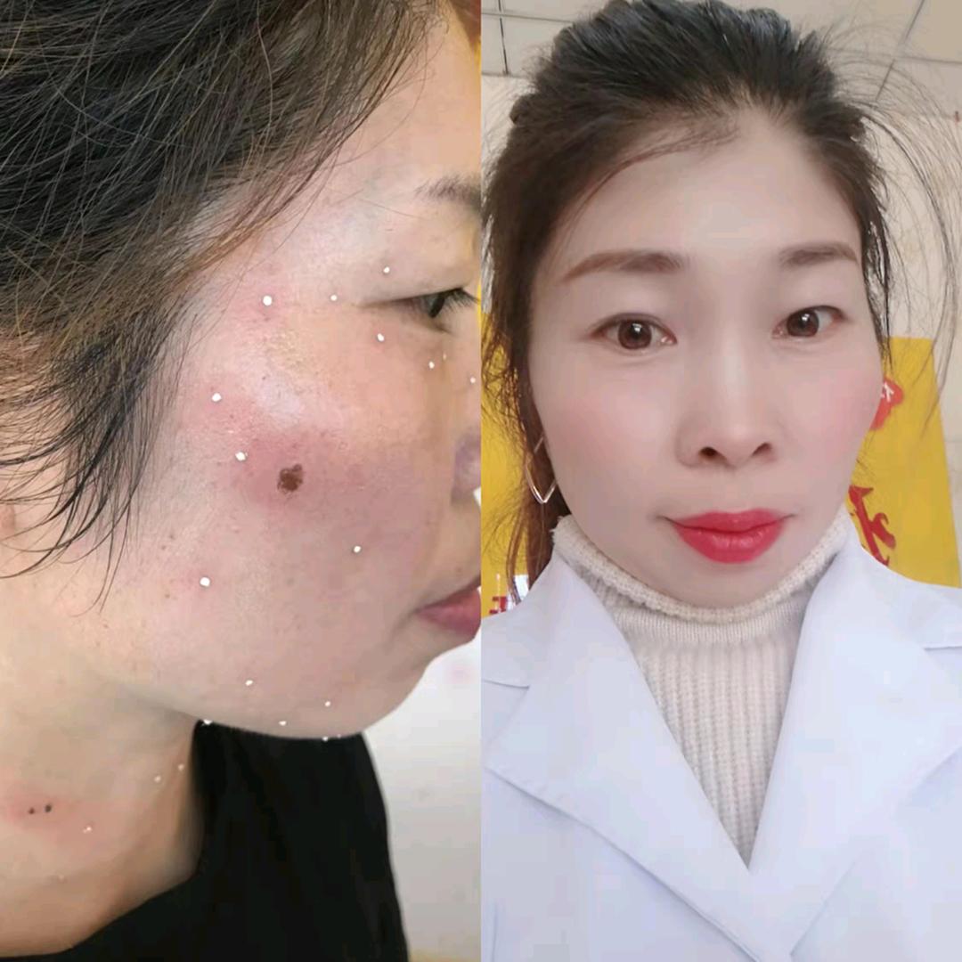 痣仁堂（嵩明店）