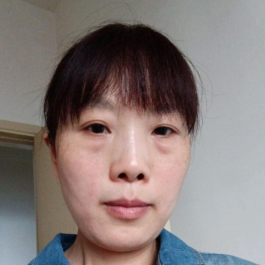 77年朱朱蛇