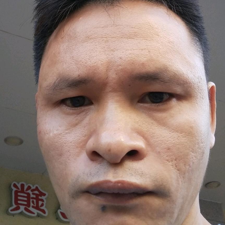 高山的猎人