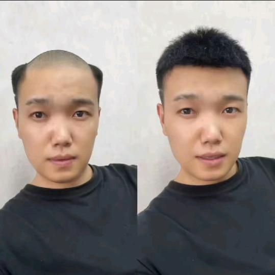 西安假发补发戴美斯