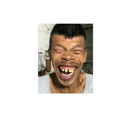发