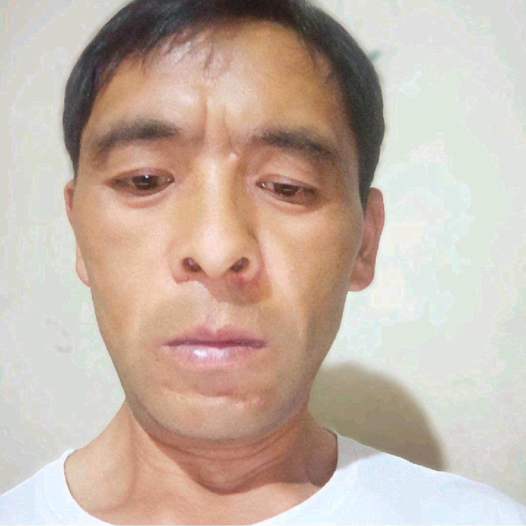 昭通镇雄