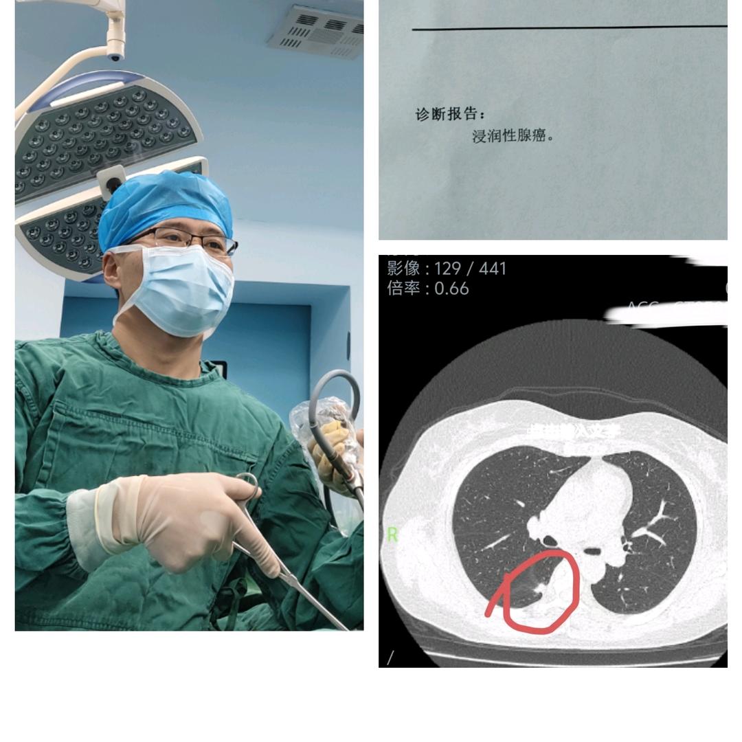 胸外科马杰医生