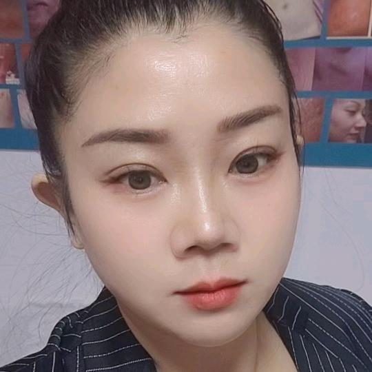 凤姐皮肤管理