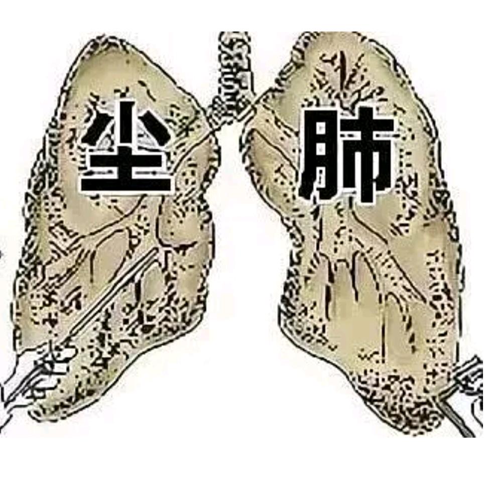 源哥防护（尘肺不可逆）