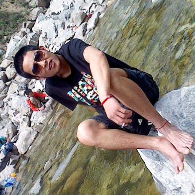 三石（血管畸形、脑动脉瘤破裂）