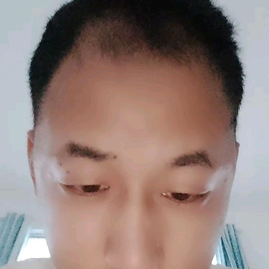 黄棚