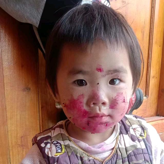 开心果  哭来包