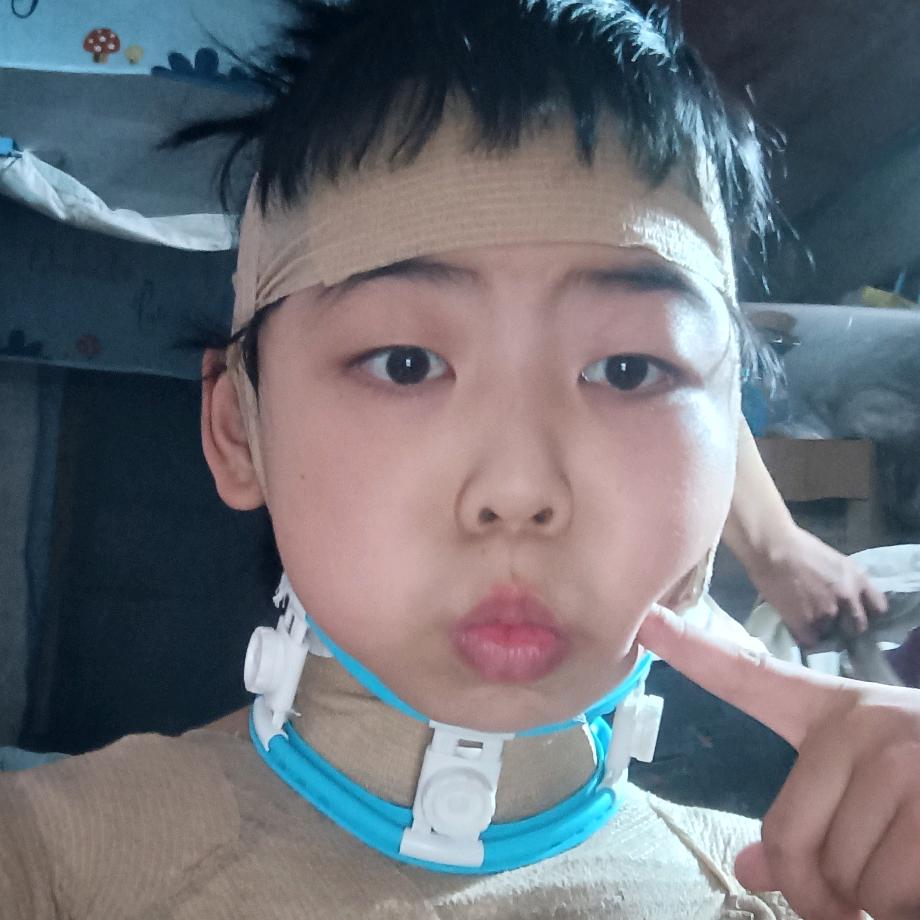 乐乐的抗疤之路