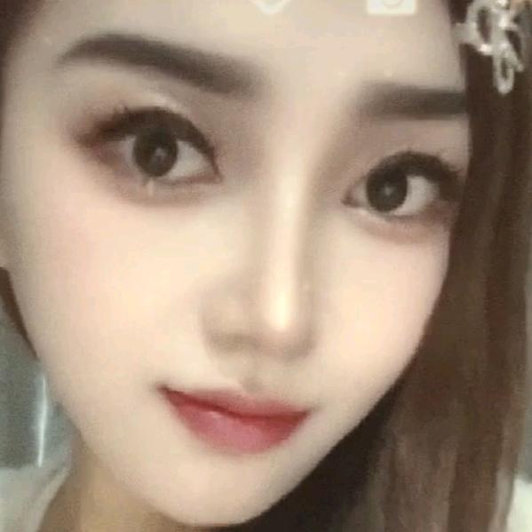 阳光