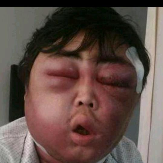 农夫三拳有点疼