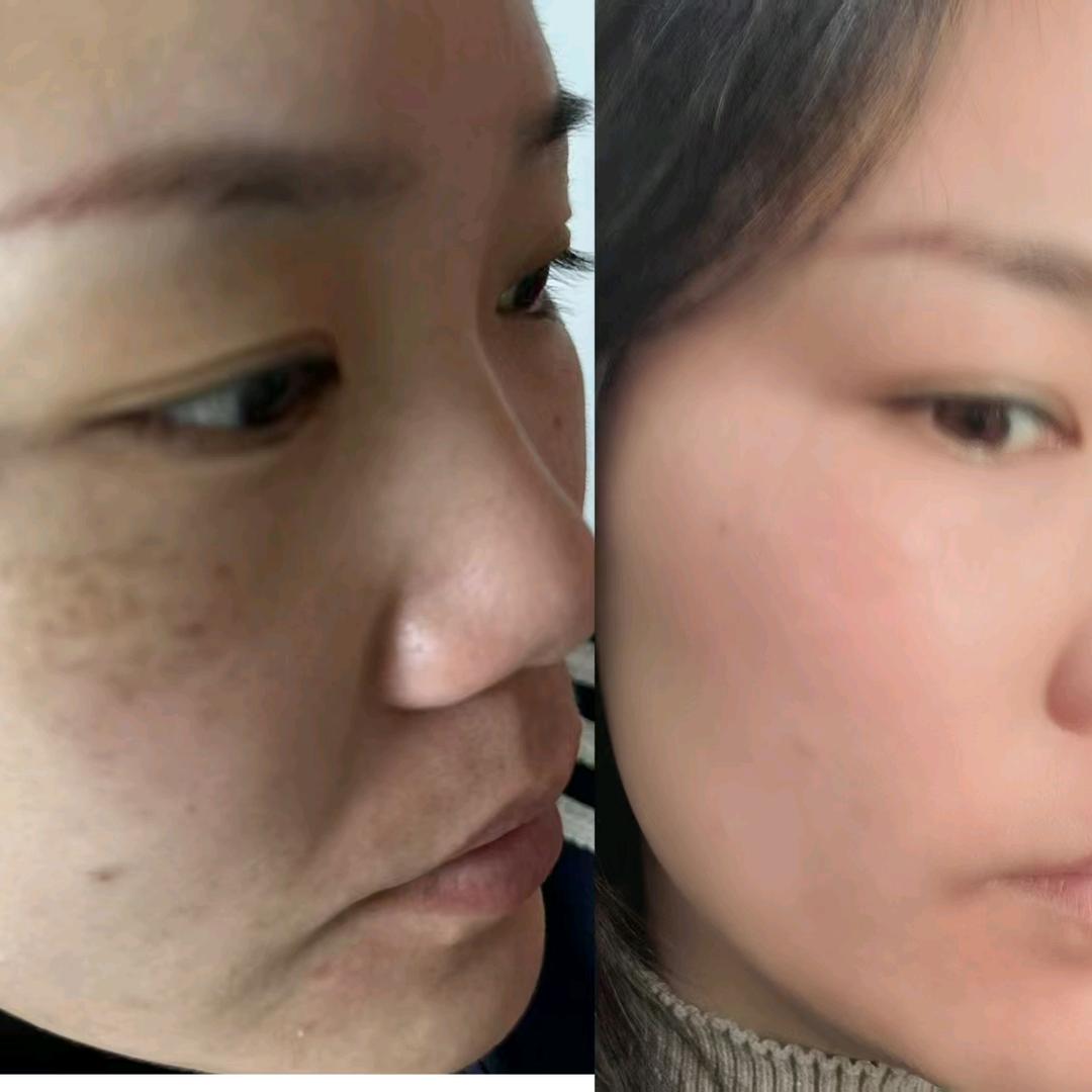 安阳问题性皮肤（灵姐）