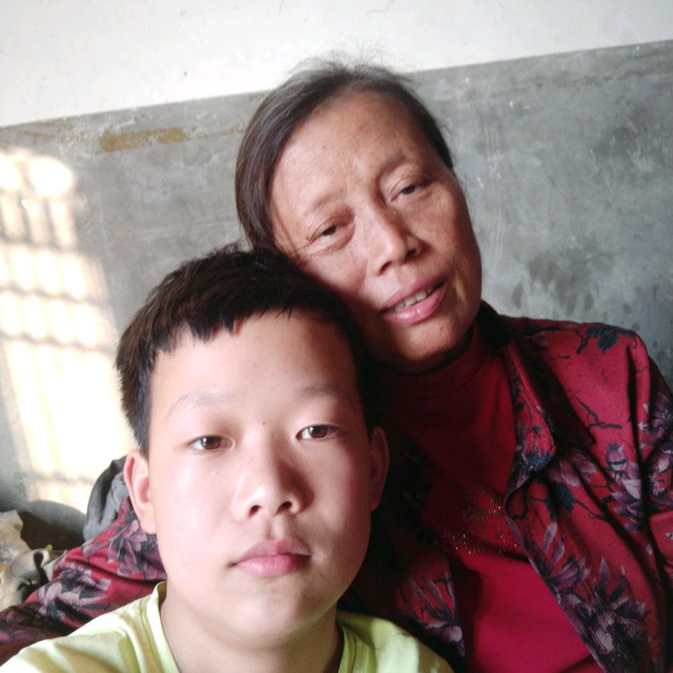 阿慧