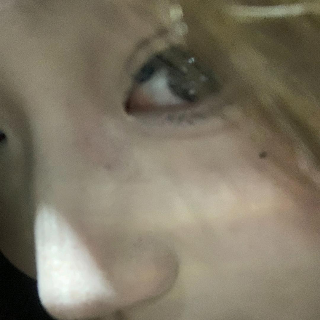 李怎么了