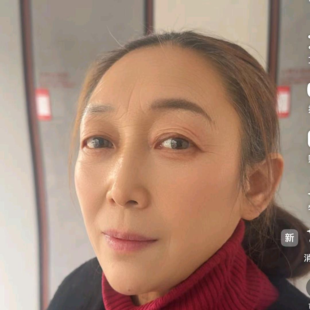 张琴