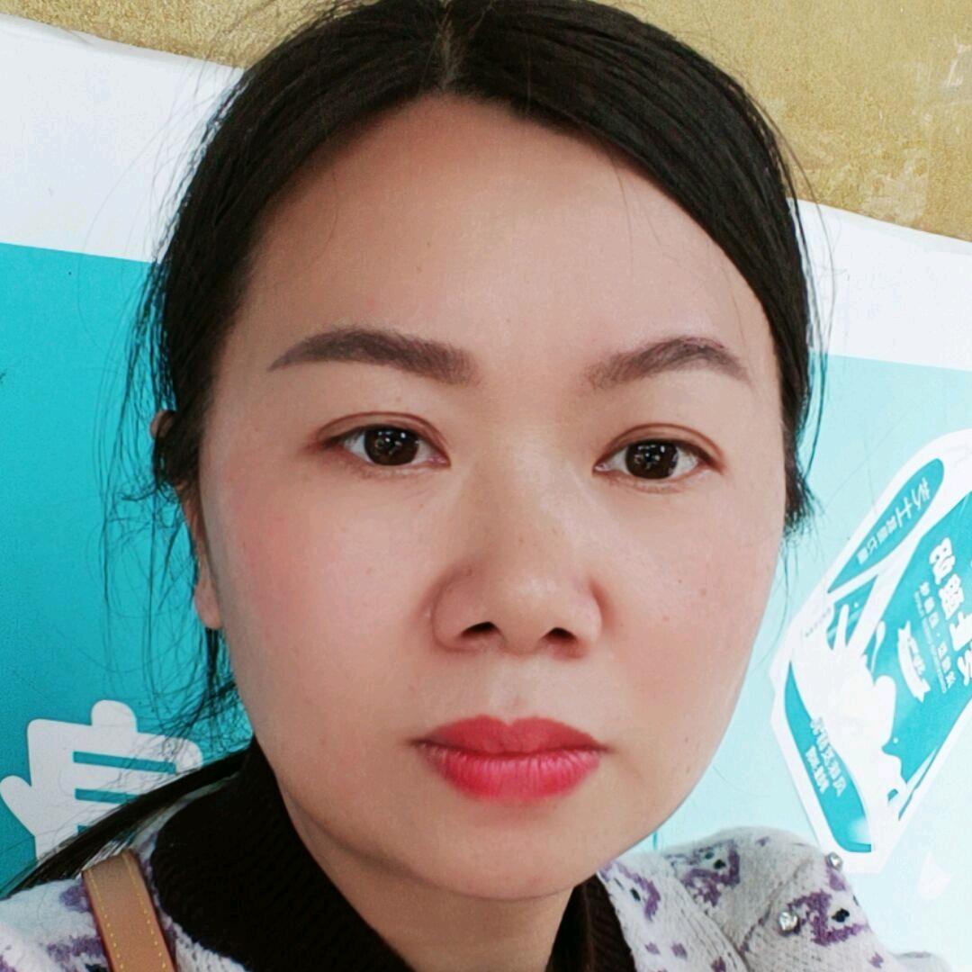 玲（驰达激光）