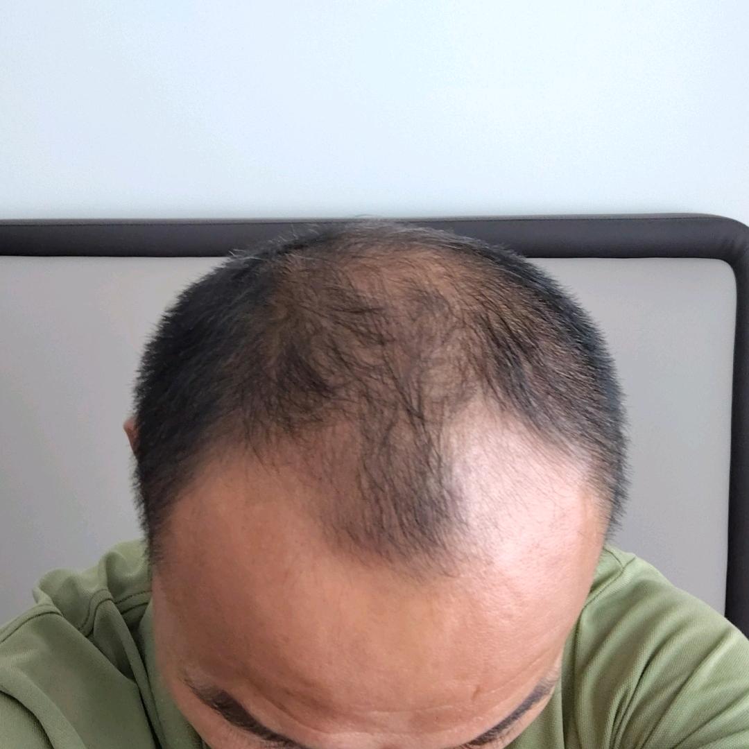 强哥养发中（徐峰指导）