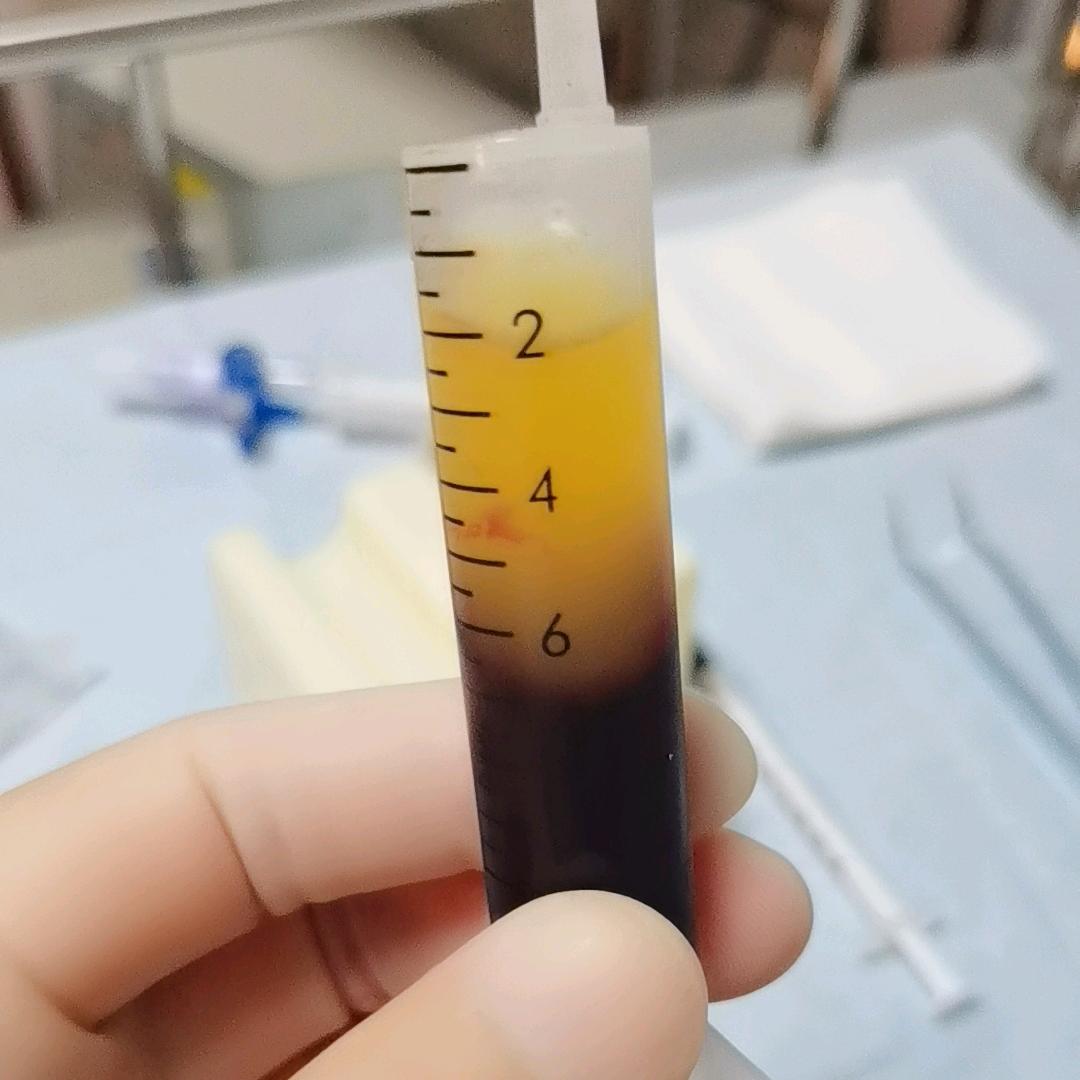 “膝”望你好